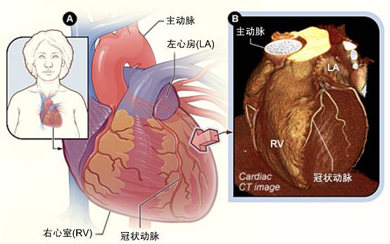 冠心病需要做哪些檢查？(圖2)